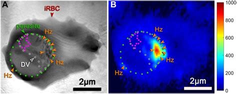 Unraveling Heme Detoxification In The Malaria Parasite By In Situ