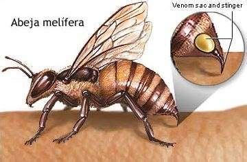 Anafilaxis Enciclopedia M Dica Ferato