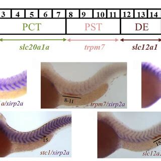 Identification Of Segments Of Zebrafish Pronephros Using Whole Mount