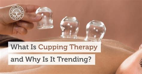 What Is Cupping Therapy And Why Is It Trending Cupping Therapy What