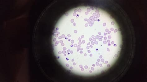 Synchronising malaria parasites - El·lipse