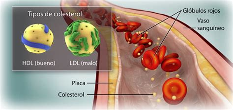 Niveles De Colesterol Ldl