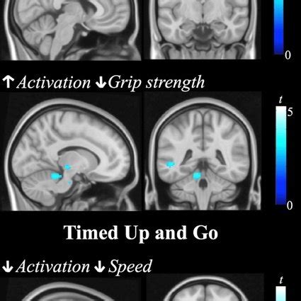 Correlation Between Brain Activation And Behavior Scores Significant