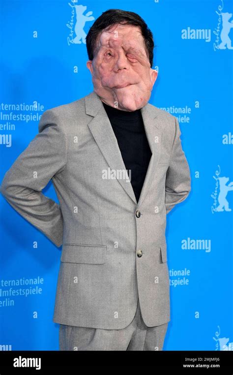 Adam Pearson beim Photocall zum Kinofilm A Different Man auf der ...