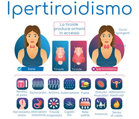 Tiroide E Ipertiroidismo Sintomi Pericoli E Cura