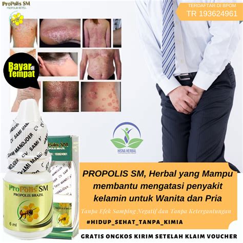 Obat Sakit Pipis Anyang Anyangan Yang Aman Obat Alami Sakit Saat