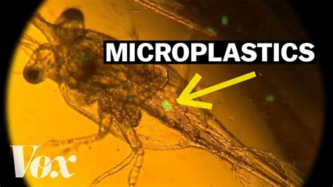 Why These Plankton Are Eating Plastic Youtube