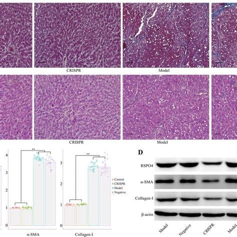 Rspo Crispr Relieve Hepatic Fibrosis In A Rat Model Of Ccl Induced