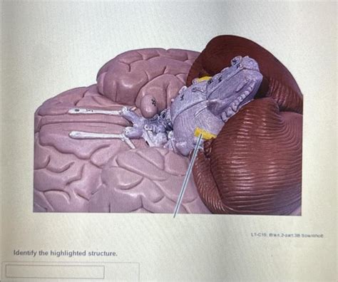 Solved Identify The Highlighted Structure Chegg