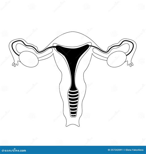 Female Genitals Outline Endometriosis Vector Illustration Stock