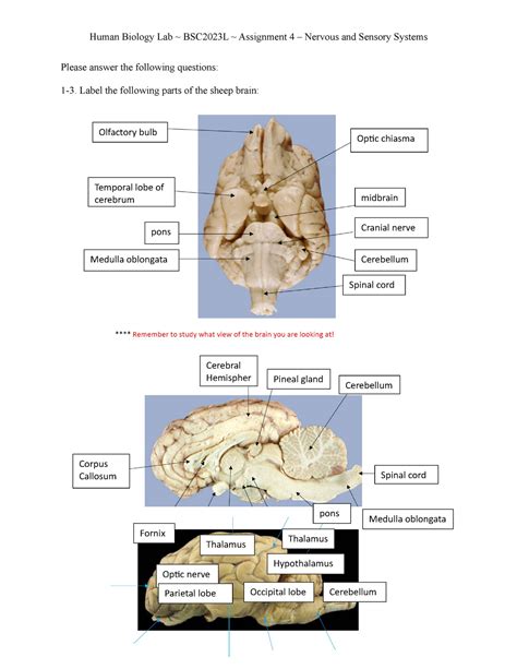 Assignment Label The Following Parts Of The Sheep Brain Optic