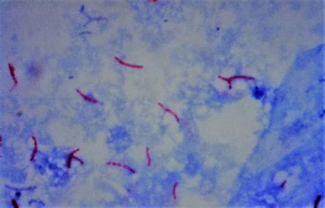 Staining Techniques Gram Staining Acid Fast Bacilli Spore And Capsule Staining