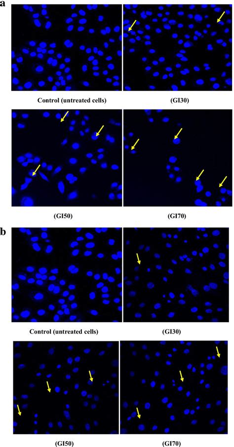 A Confocal Micrographs Of Pc Cells Treated With Ce Of A Fumigatus B