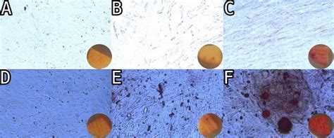 After Alizarin Red Staining And Mineralization Assay Of Hascs On