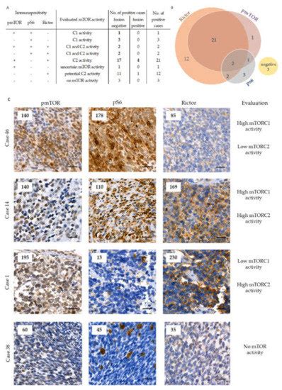Cancers Special Issue Rare Childhood Malignancy