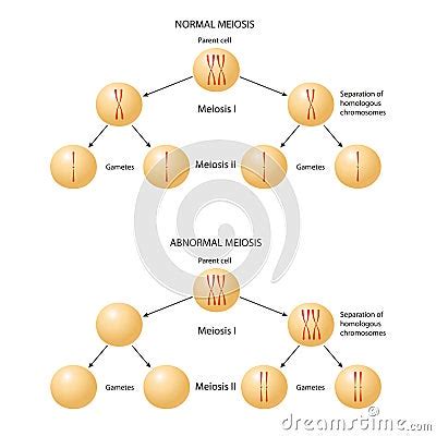 Abnormal Chromosome Inheritance Nondisjunction Normal And Abnormal