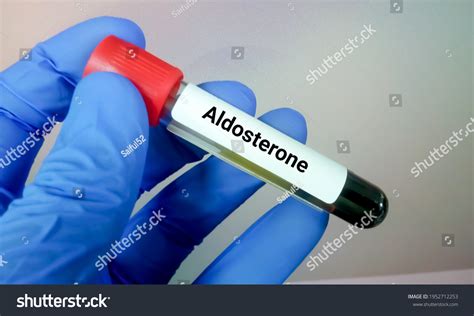 Blood Sample Aldosterone Hormone Test Stock Photo 1952712253 | Shutterstock