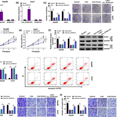 Overexpression Of Circ DYNC1H1 Relieved The Lidocaine Mediated HCC