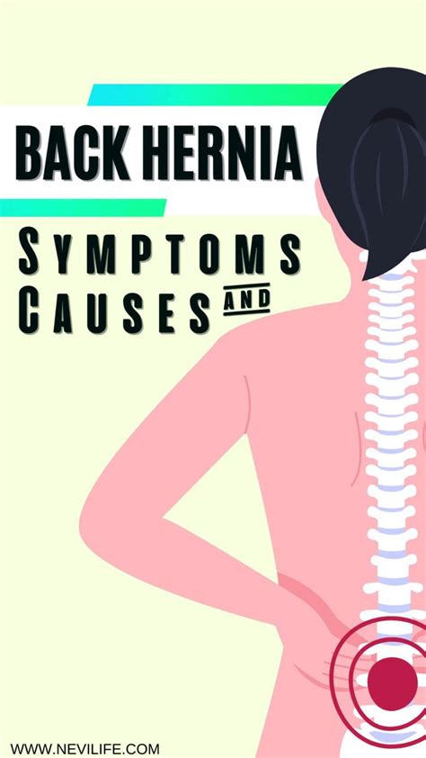 Lower back pain lower back hernia herniated disc causes and symptoms ...