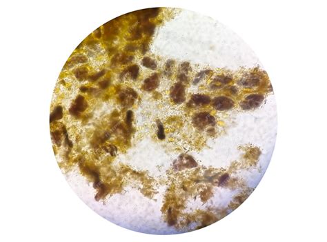 Exame De Fezes Sob Microscopia De Luz Análise De Fezes Foto Premium