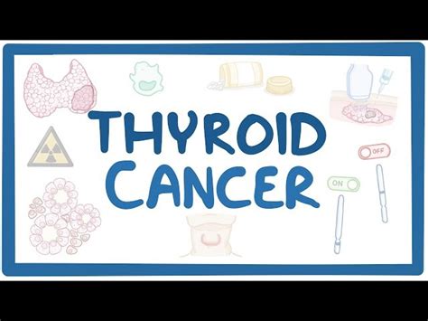 Thyroid cancer - causes, symptoms, diagnosis, treatment, pathology ...