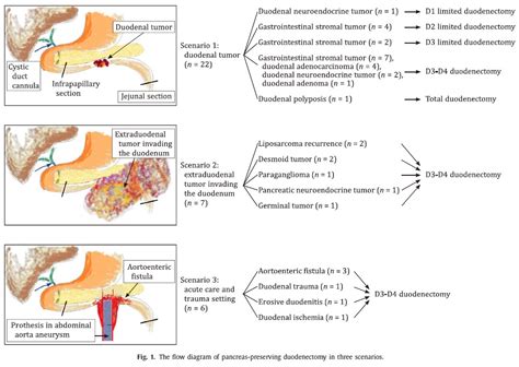 Pancreas Preserving Duodenectomy Surgical Focus