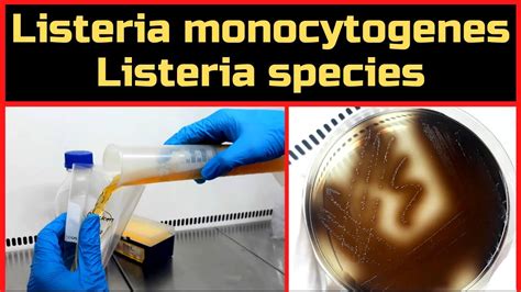 Listeria Karey Stroud