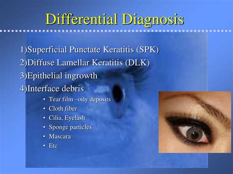 PPT - LASIK & PRK: Potential Post-op Corneal Opacities PowerPoint Presentation - ID:1589727