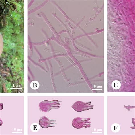 Basidiomata And Microscopic Structures Of Pseudohydnum Abietinum