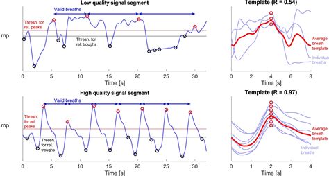 impedance pneumography signal quality index design assessment