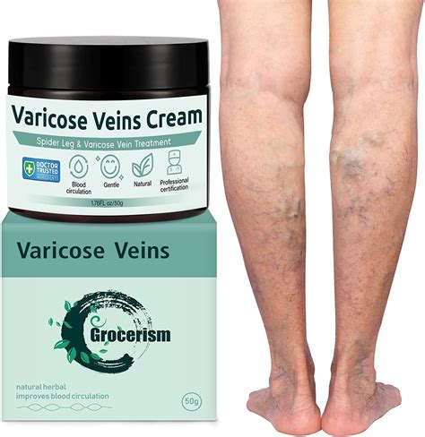 Cr Me Pour Les Varices G Varices Traitement Jambe Adapt E Aux Veines