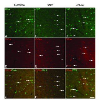 Pairs A D B E C F Of Fluorescence Photomicrographs Of Oxa C Fos