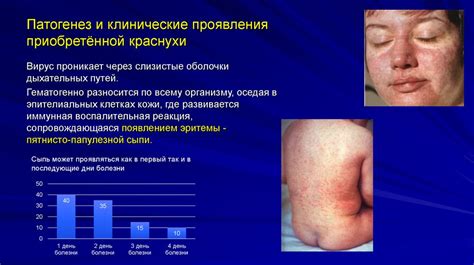 Вирус краснухи - online presentation