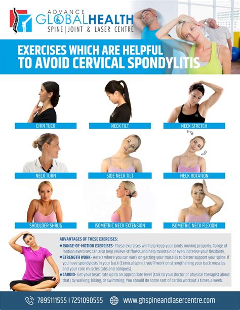 Cervical Spondylosis Exercises