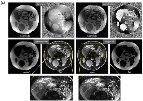 Bioengineering Special Issue Ai In Mri Frontiers And Applications