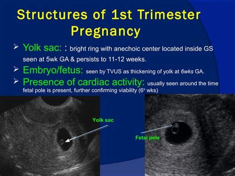 Early pregnancy ultrasonographic evaluation