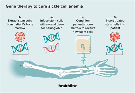 🌷 Gene Therapy Pros And Cons Pros And Cons Of Gene Therapy 2022 10 23