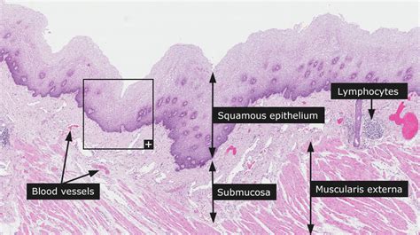 Dictionary - Normal: Esophagus - The Human Protein Atlas