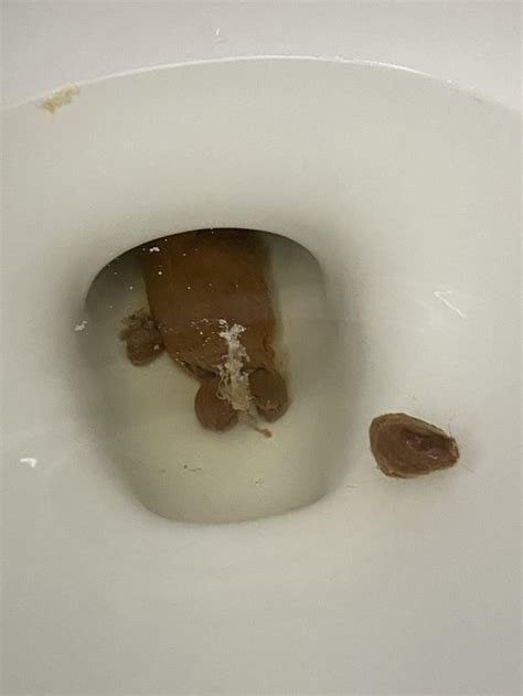 I Saw This Weird Stringy Stuff In My Poop Does Anyone Know What It Is