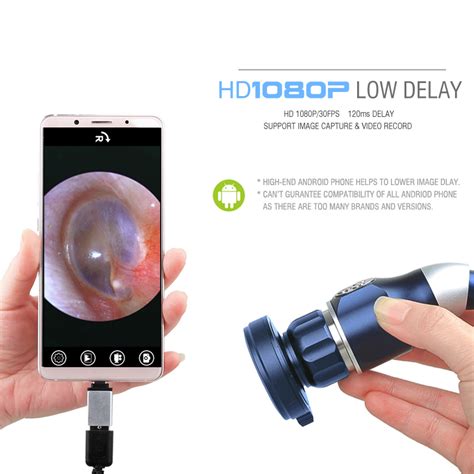 USB/HDMI 1080P Portable Endoscope Camera - Ayersmed