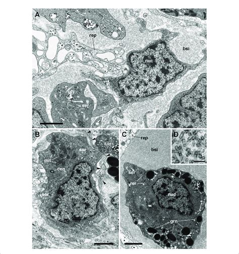 Renal Blood Sinuses Hemocytes And Hemocyanin Polymers Under Tem