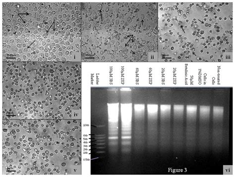 Cell Morphology Of A Human Leukemic Cancer Cell Lines U937 After