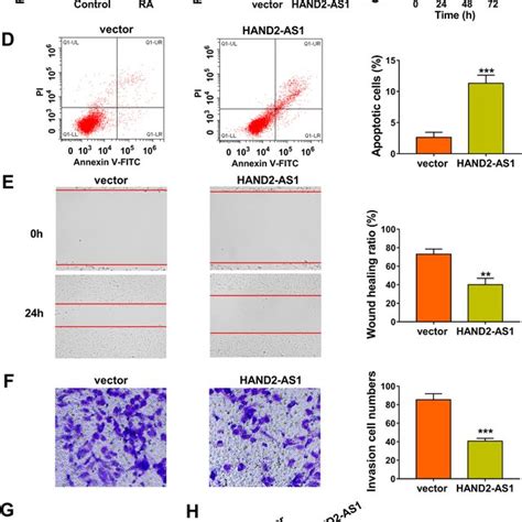 Hand As Upregulation Inhibits Tumor Like Biologic Behaviors Of