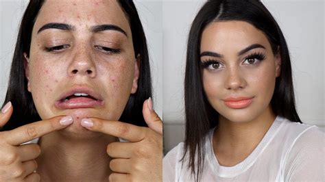 How To Cover Your Breakouts Flawless Skin Tutorial Youtube