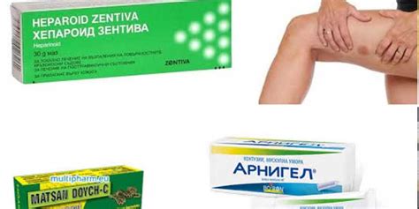 Контузии и синини (хематоми). Лекарства, билки, съвети – Лекар.БГ
