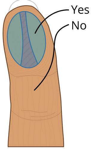 Performing Venipuncture Capillary Puncture Flashcards Quizlet