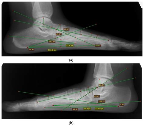 Diagnostics Free Full Text Diagnostic Accuracy Of Various