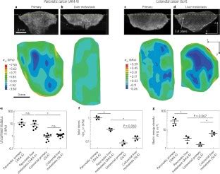 Solid Stress And Elastic Energy As Measures Of Tumour Mechanopathology