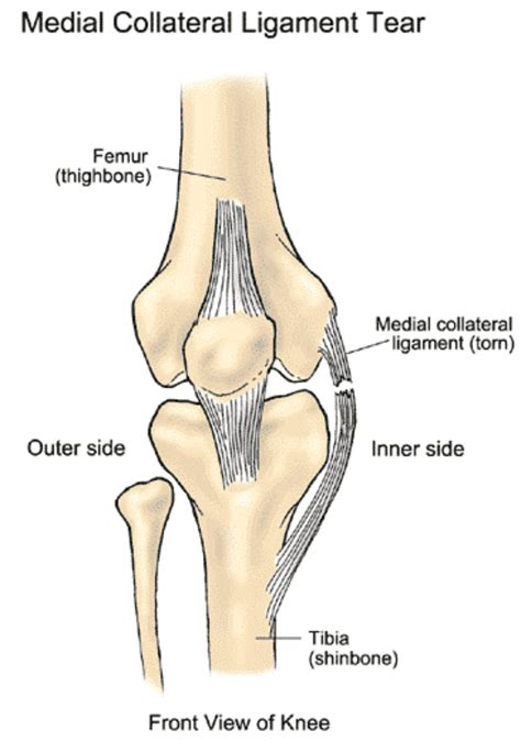 Medial Collateral Ligament Mi Pro Co Uk