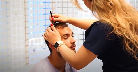 Hair Transplant In Mexico Tijuana Vatanmed Clinic